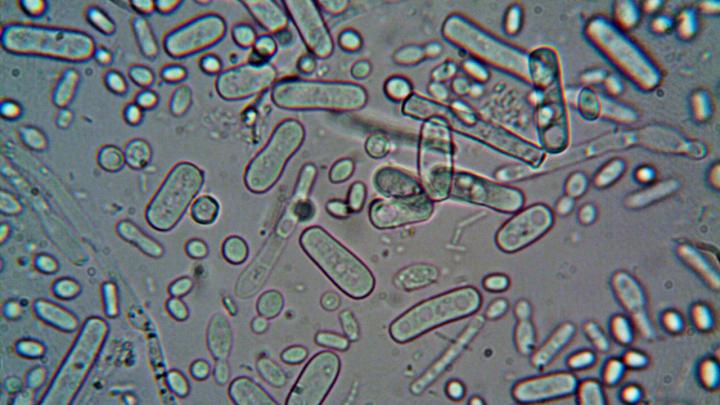 Microorganisms under a Microscope © Pexels, turek