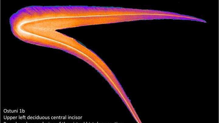 (Synchrotron) light shed on ancient fossils